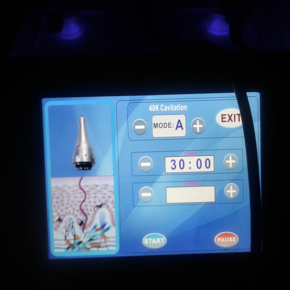 Cavitation Machine - Picture 3 of 4